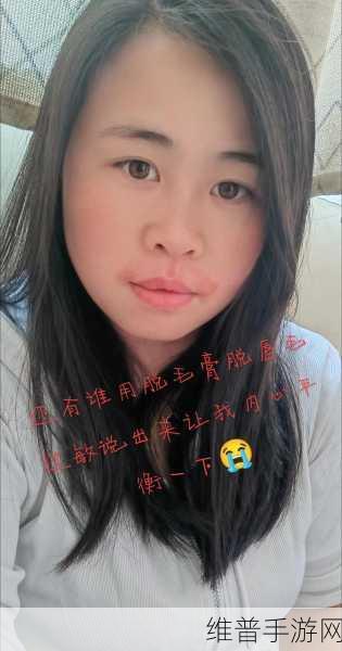 16岁唇毛明显到18岁还会长吗：16岁唇毛明显，18岁时会继续生长吗？探讨青春期的变化与影响。