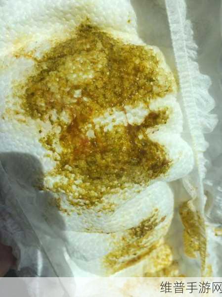 宝宝夹的好紧都拉丝了正常吗图片：宝宝夹的拉丝现象正常吗？详解及注意事项。