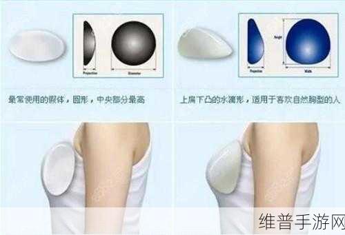 水滴形和圆形丰胸对比：1. 水滴形与圆形丰胸效果大比拼