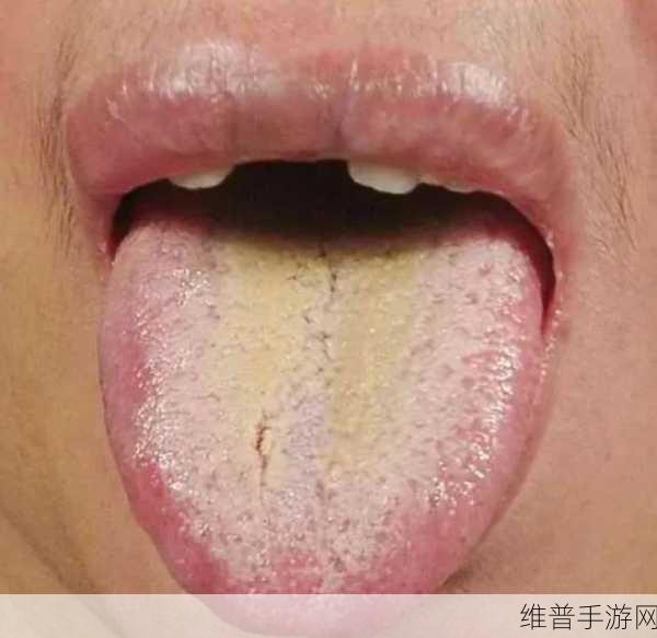舌头往下舔到一个硬硬的包疼痛:舌尖探秘:从疼痛包块看口腔健康的重要性
