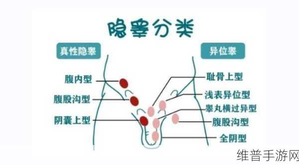 不小心看到了男生的睾丸怎么办：1. 意外目睹男生隐私，如何应对尴尬局面？