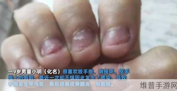 才三根手指就痛：1. 三根手指的痛，背后隐藏了怎样的故事？