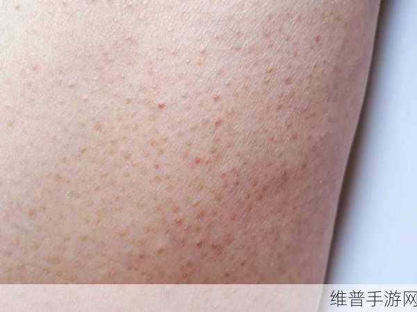 女性三角毛毛区长了个硬疙瘩：女性私密区域出现硬疙瘩的原因及处理方法解析