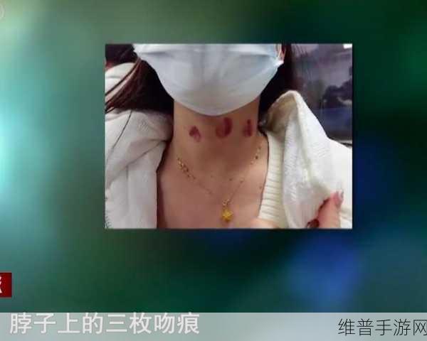 吻痕（1v1，h）情感对决：1. 深夜悄然相拥，吻痕背后的爱情秘密