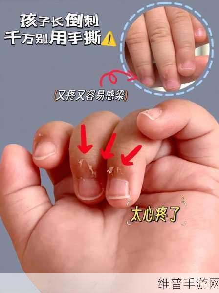 宝宝才三根手指就这么疼：1. 宝宝小手三根指，疼痛背后隐藏的故事