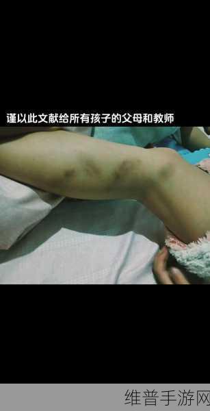 严厉的管教体罚故事：1. ＂严厉管教：父母的体罚与孩子心灵的挣扎