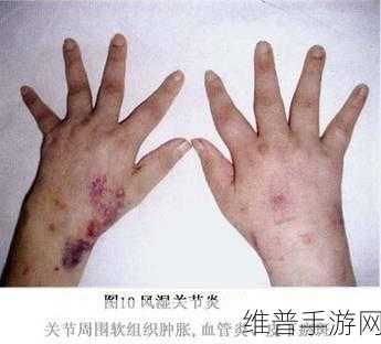 小扫货水能么多叫出来骨科过度使用引发问题：1. 骨科过度使用导致的健康隐患与解决方案