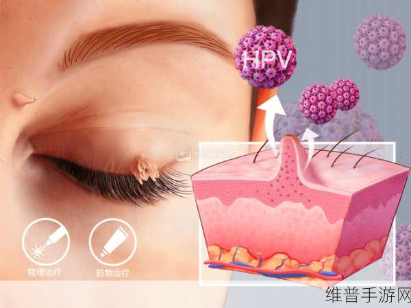 女的用嘴巴吃鸡会得HPV即将上市:1. 女生用嘴吃鸡,HPV风险新研究引关注