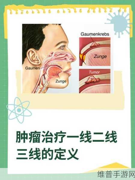 欧洲无线一线二线三线区别：1. 欧洲无线网络一线、二线、三线的全面解析