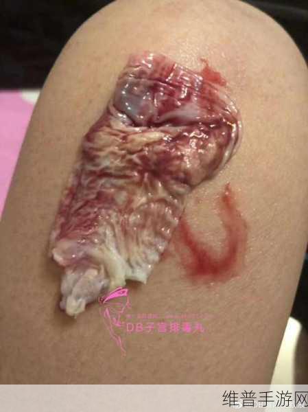 老中医给雨萱排阴毒：1. 老中医教你如何排除体内阴毒