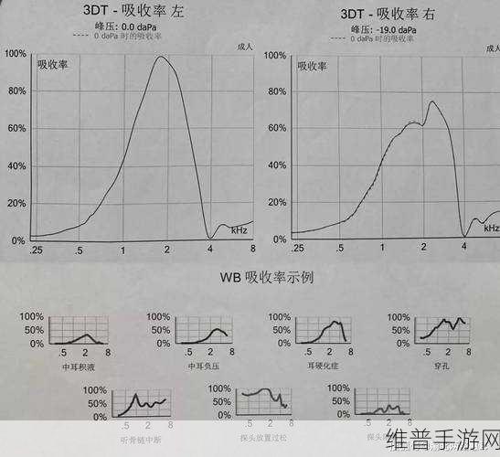 阻抗对音频设备的影响,手游公司角度下的音频攻略深度解析及静态阻抗与动态阻抗的区别